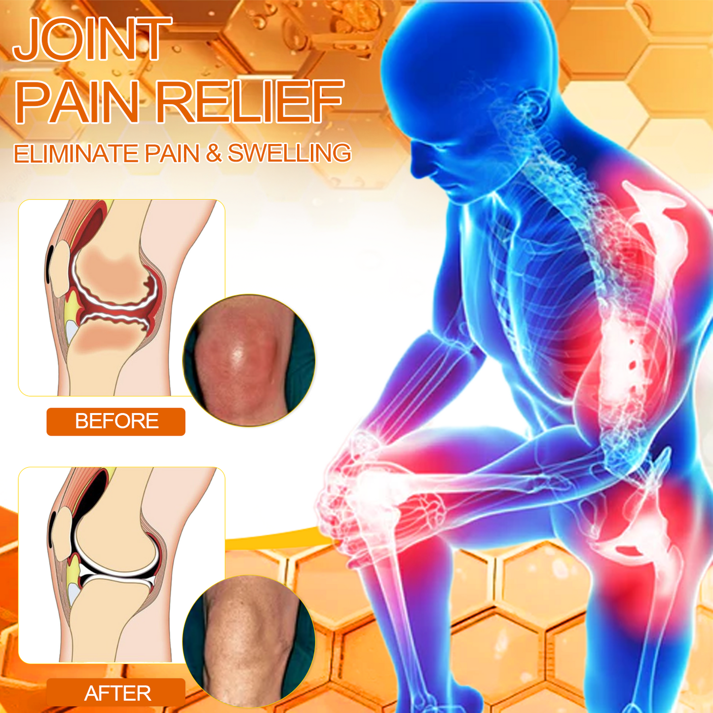 Bee Venom Arthritis Therapy Cream(Specializing in Orthopedic conditions and joint pain & AAOS recommends)