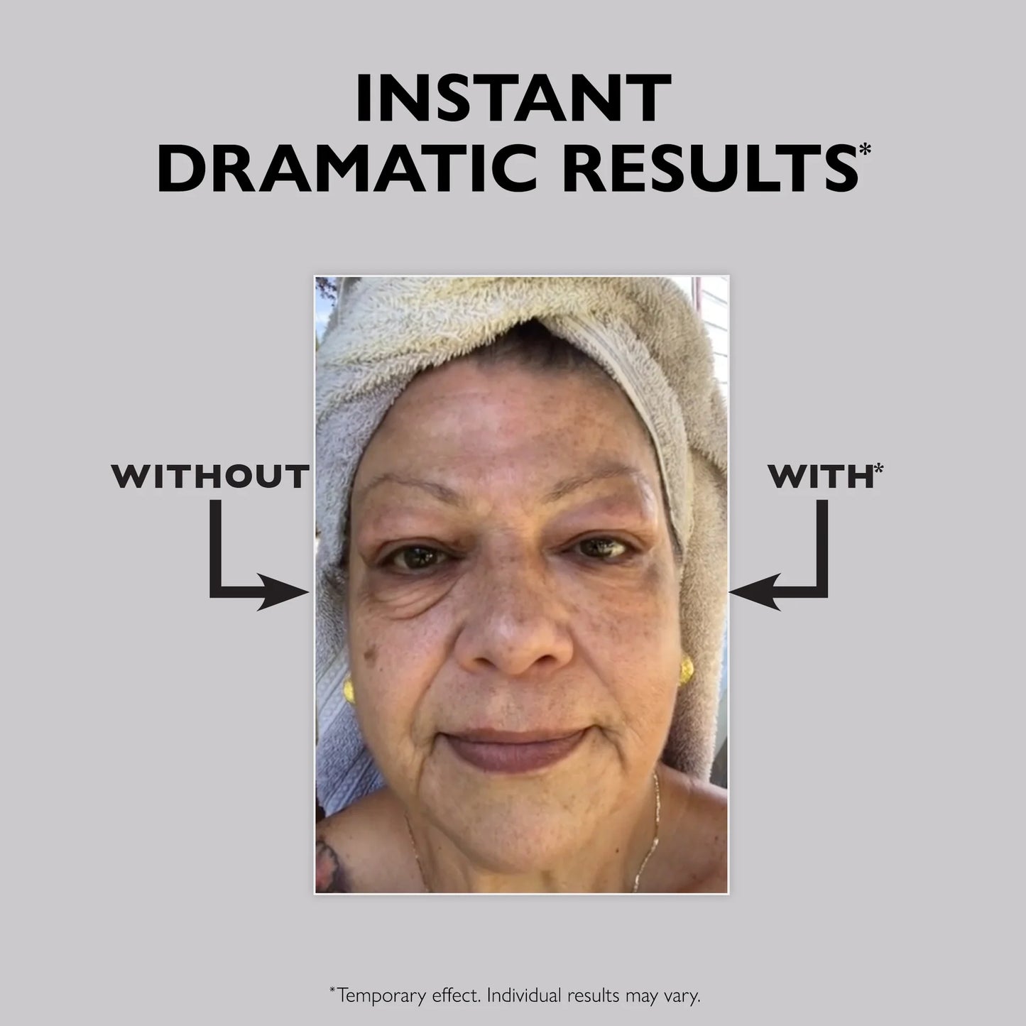 Instant FIRMx Eye Temporary Eye Tightener