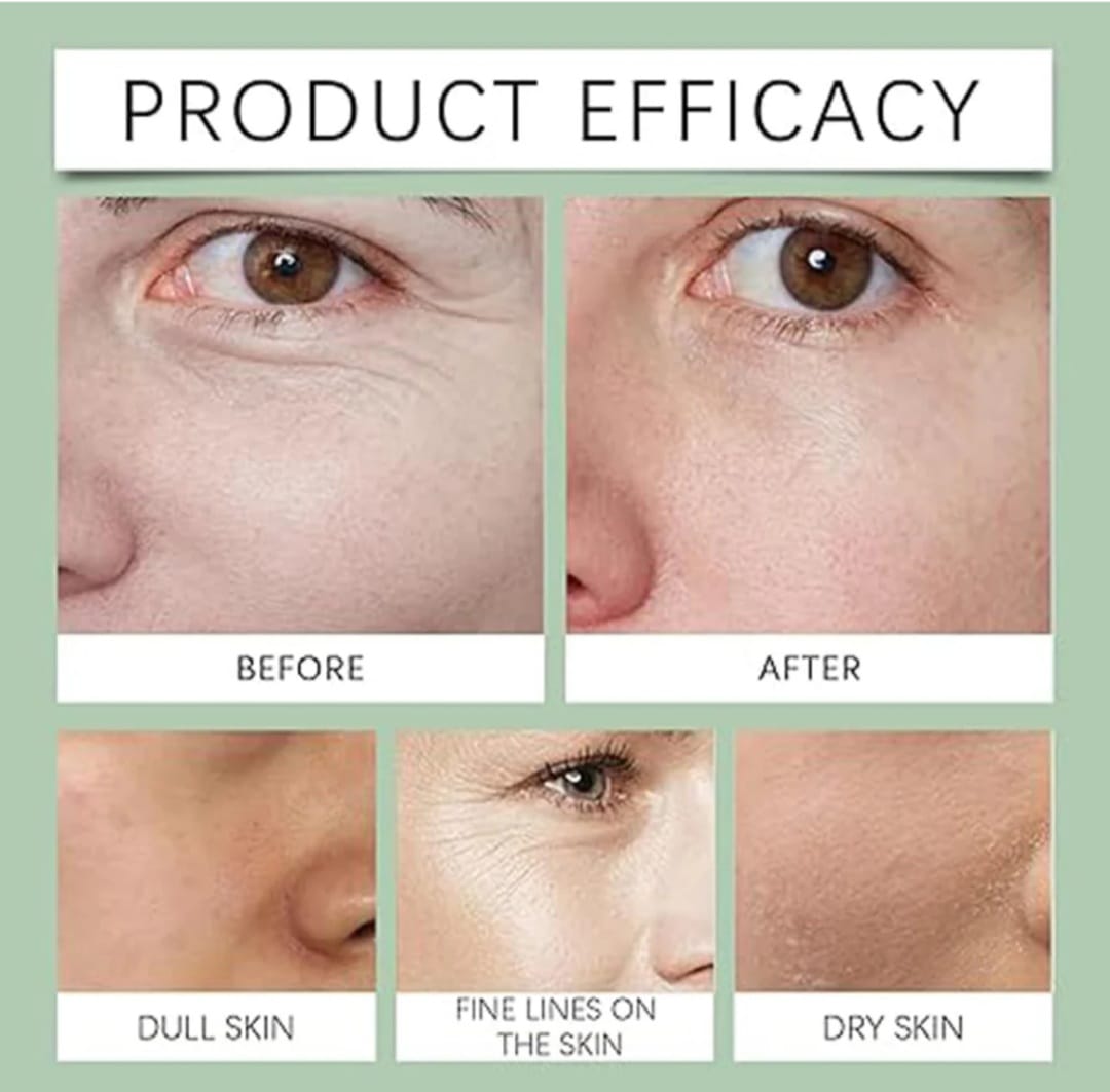 Anti Wrinkle Multi Purpose Cream
