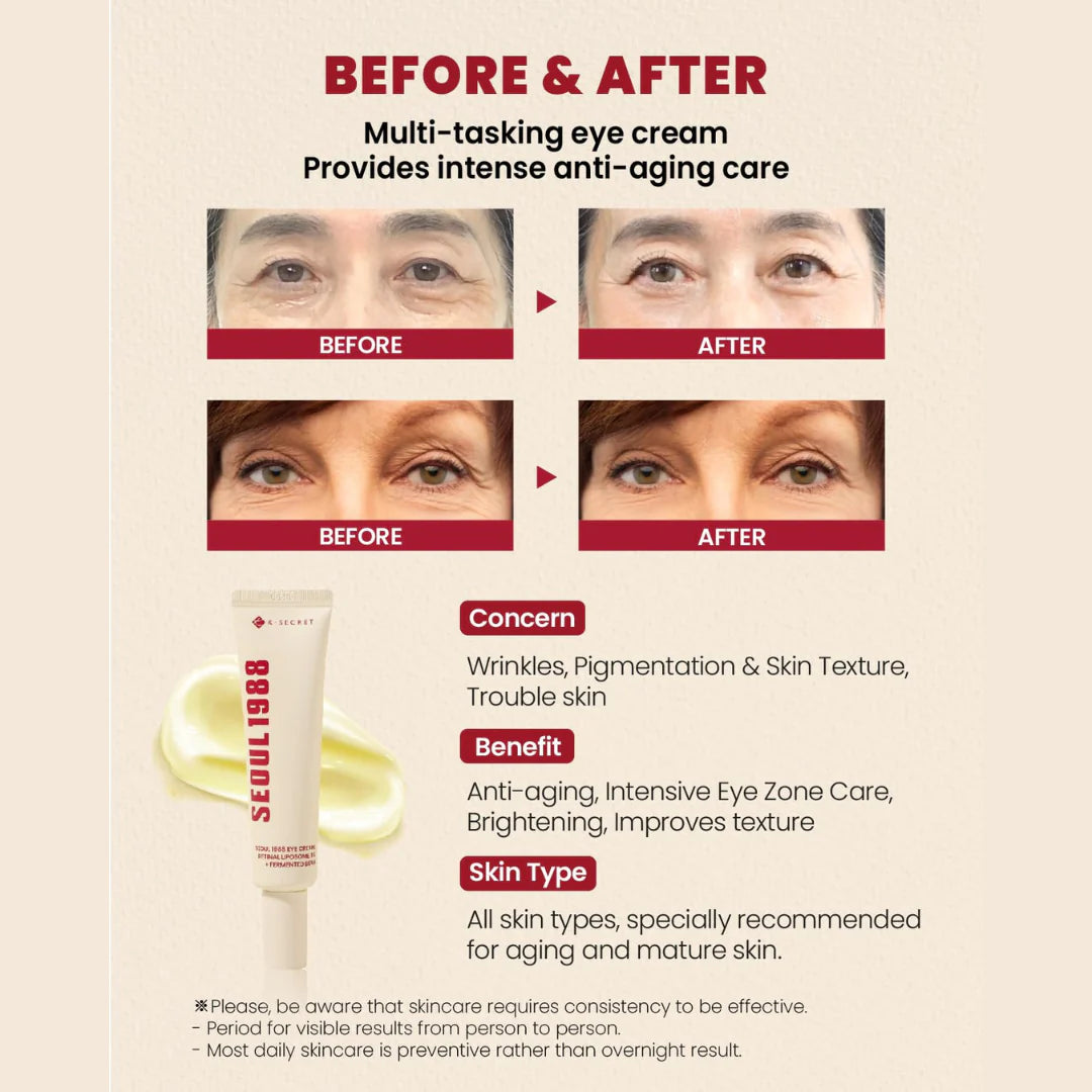 KSECRET SEOUL 1988 Eye Cream