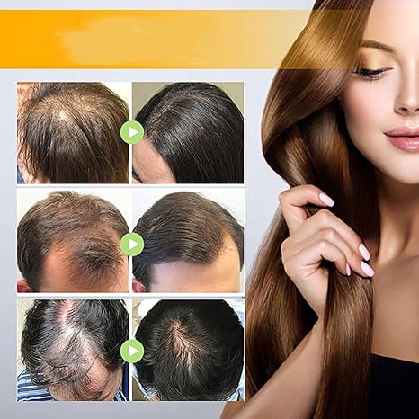 Onest Cosmetics Anti-Greying Hair Growth Oil, Onestcosmetics Anti Greying Hair Growth Oil, Rosemary Hair Oil Serum Anti Hair Loss Nourishing Serum