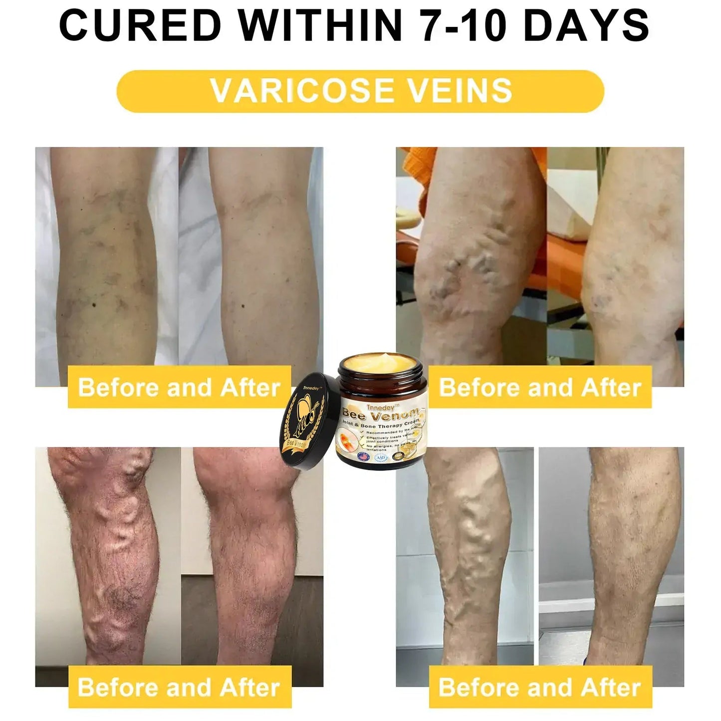 Bee Venom Arthritis Therapy Cream(Specializing in Orthopedic conditions and joint pain & AAOS recommends)