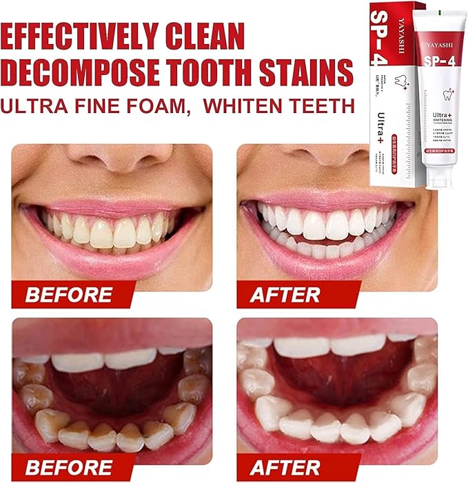New Sp-4 Toothpaste