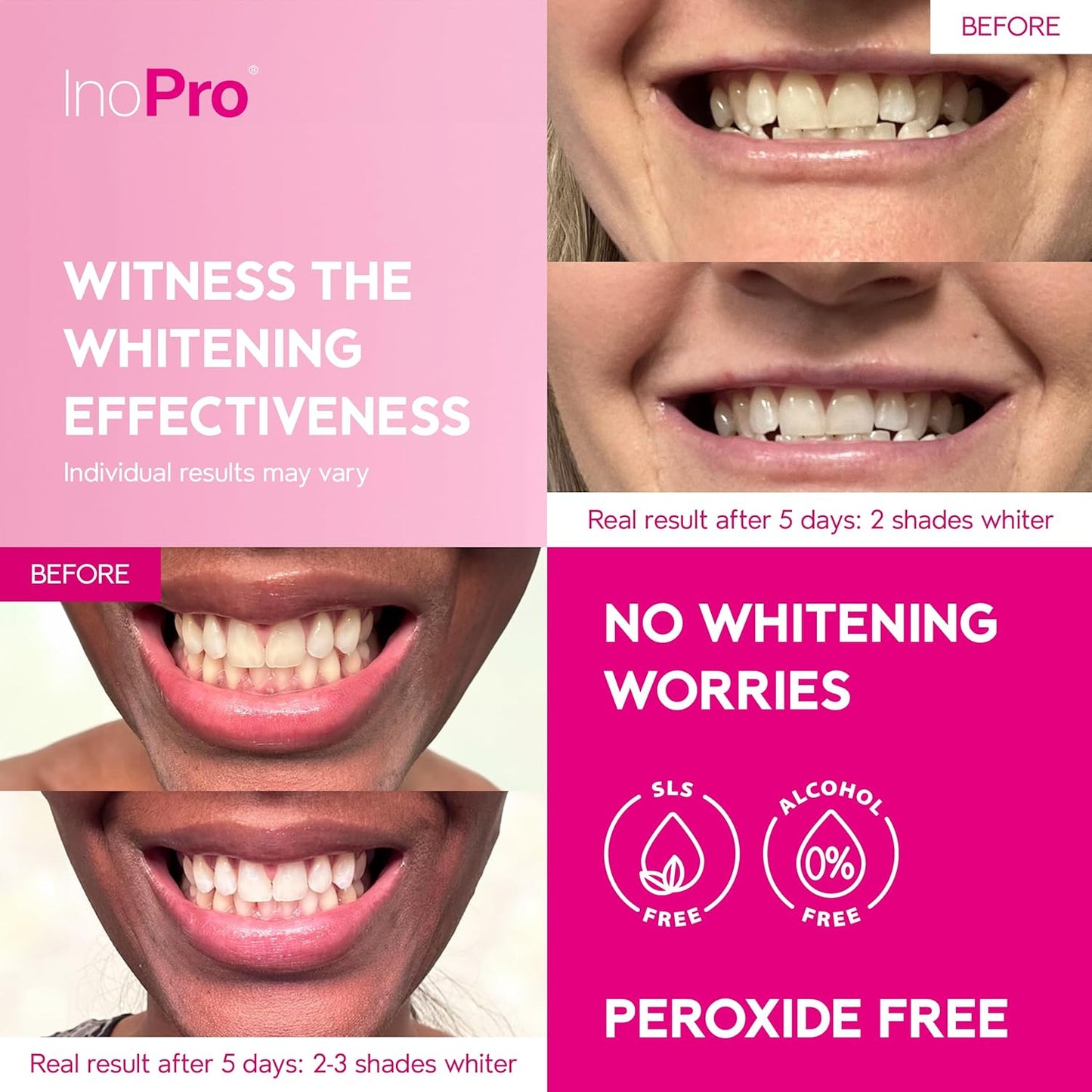 FreshGlow Teeth Strips