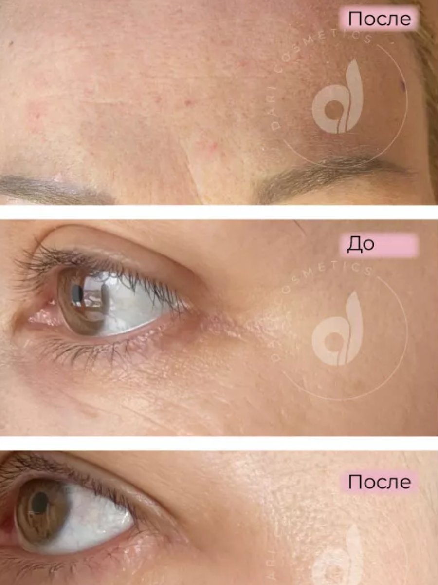 Dari Cosmetics Peptide filler cream for the skin around the eyes