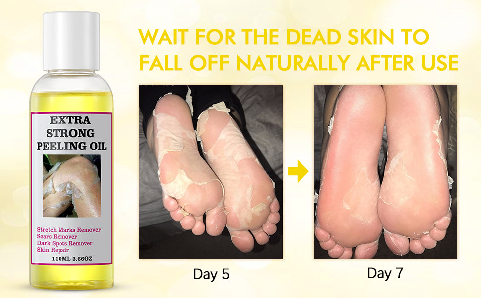 Extra Strong Yellow Peeling Oil for lightening the dark spots of all body parts