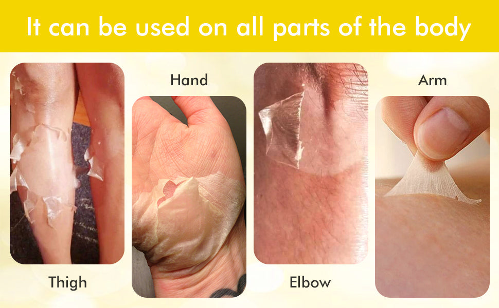 Extra Strong Yellow Peeling Oil for lightening the dark spots of all body parts
